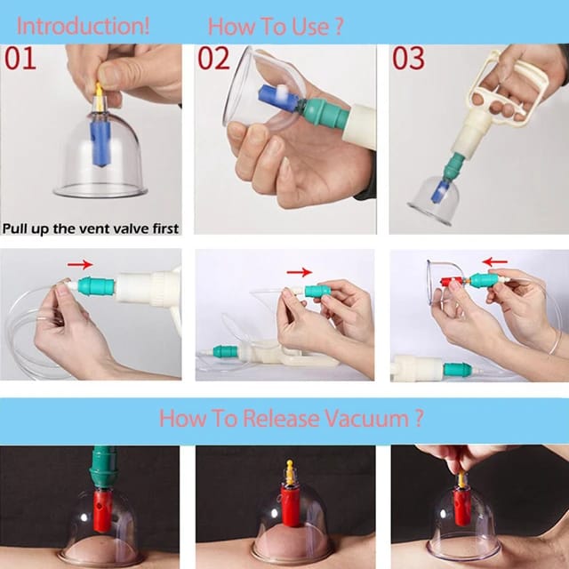A Person is demonstrating how to use Vacuum Cupping Therapy Set.