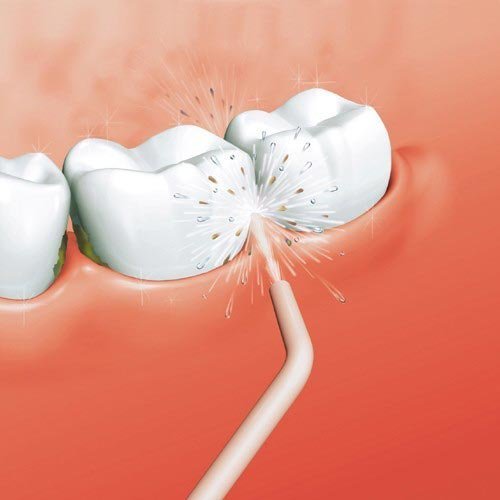 Portable Power Floss Dental Water Jet Cords Tooth Pick No Batteries
