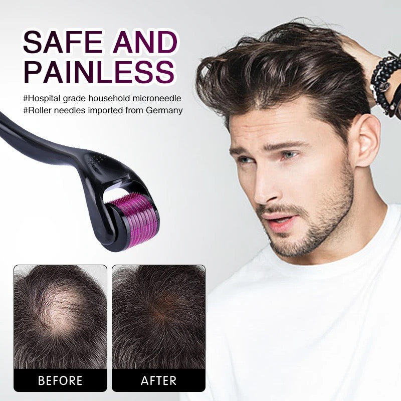Comparing before and after use of needle roller