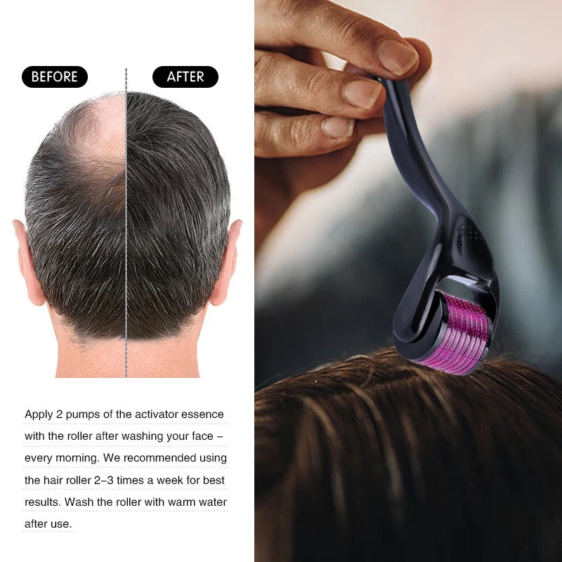 Comparing before and after use of needle roller