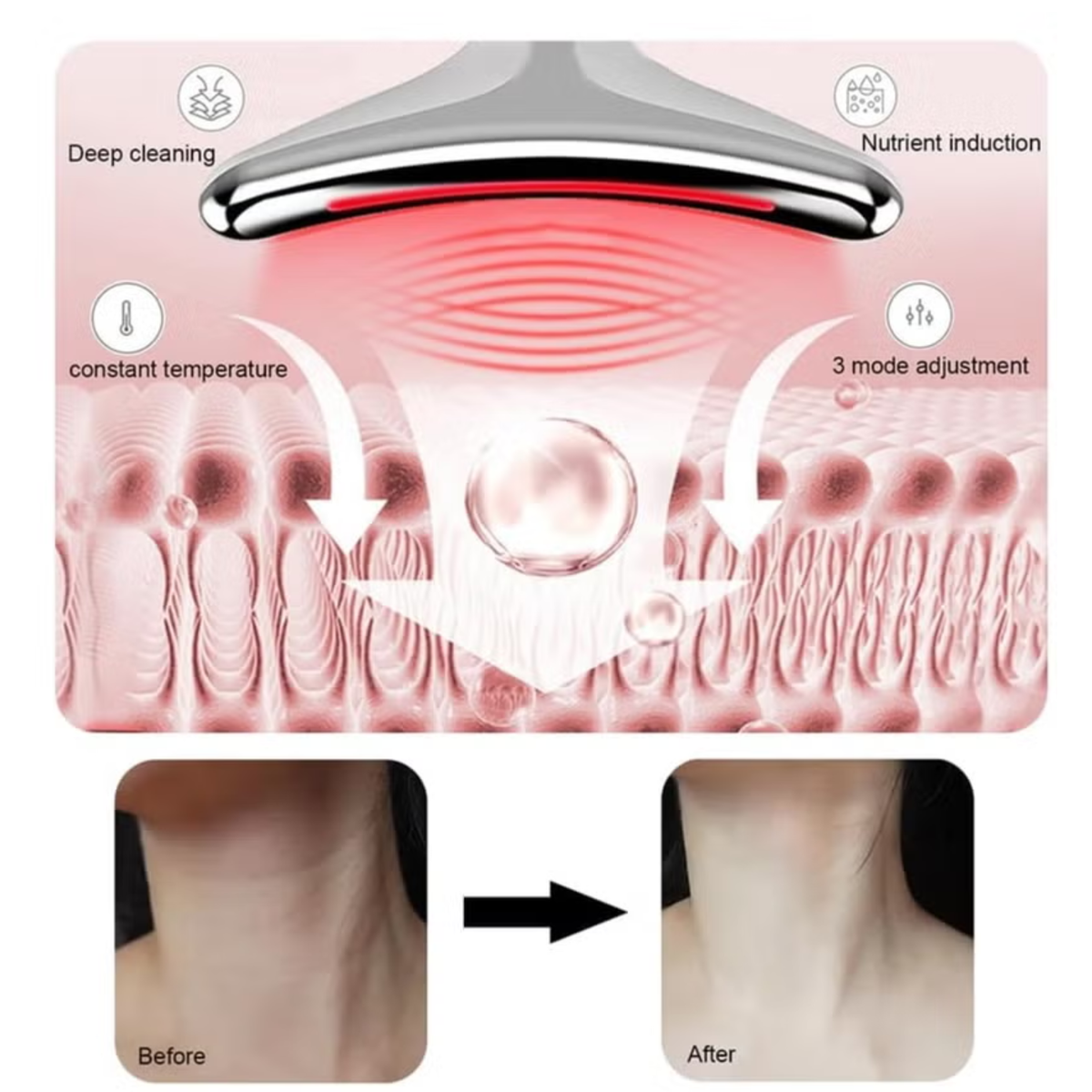 Image shows the features and after usage of Intense Pulsed Light Wrinkle Reducing Instrument.