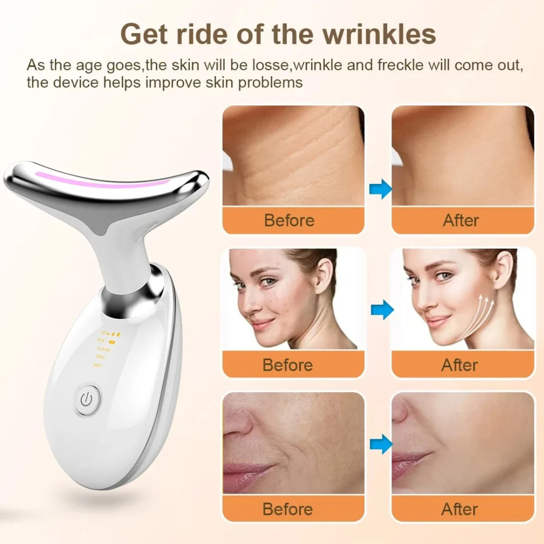 Image shows the before and after usage of Intense Pulsed Light Wrinkle Reducing Instrument.