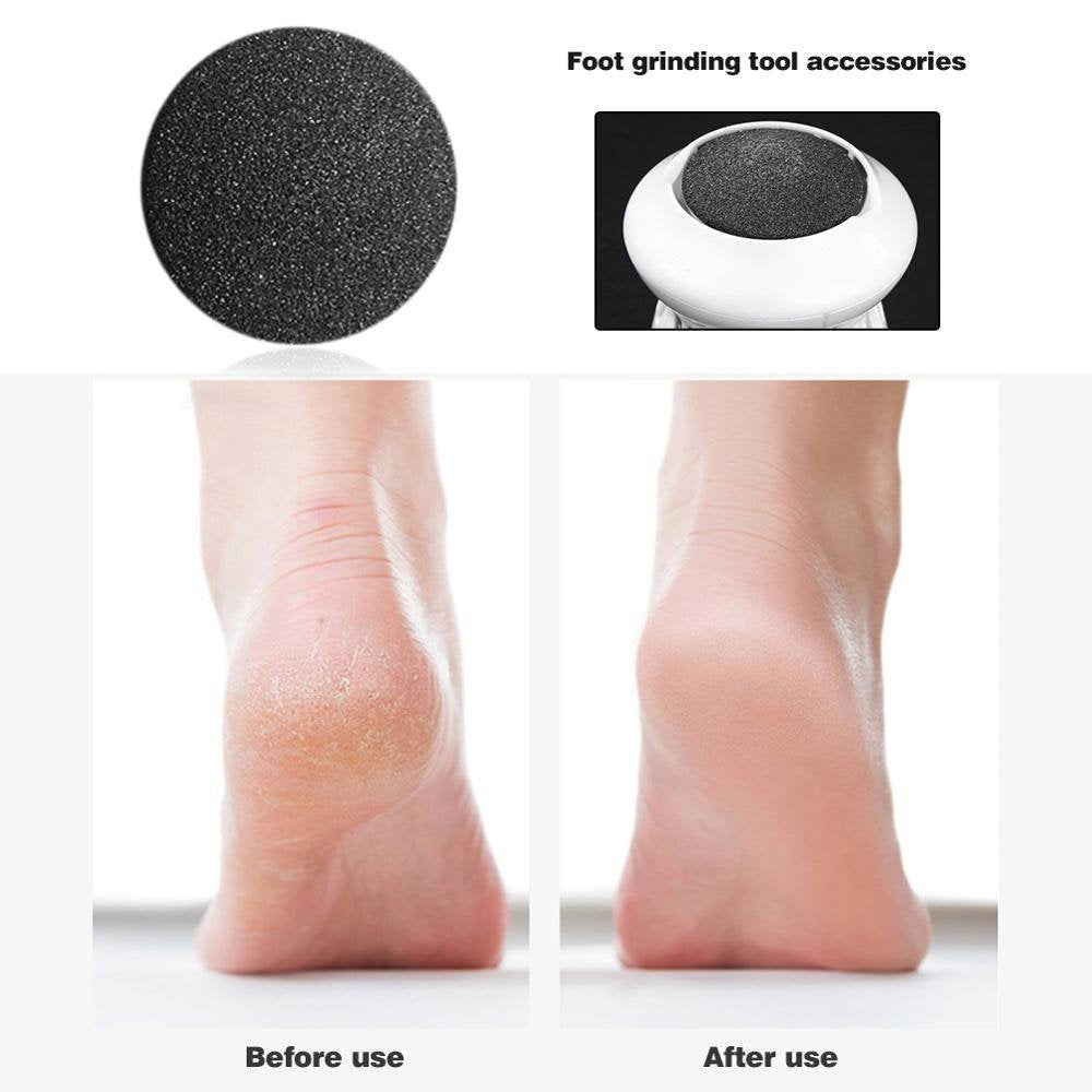  Powerful Electric Foot Callus Remover, Rechargeable Pedicure  Tools Electric Foot File with Smart Light, Fine & Coarse Roller Heads, AM  8:00 Callus Remover for Feet for Dead Hard Cracked Dry