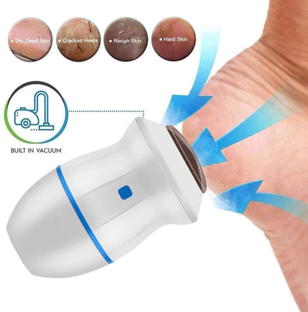 Portable Electric USB Vacuum Adsorption Foot Grinder, Foot File Pedicure, Dual-Speed Callus Remover
